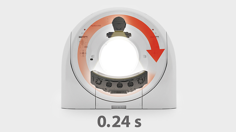 Aquilion ONE INSIGHT 0.24 s rotation speed