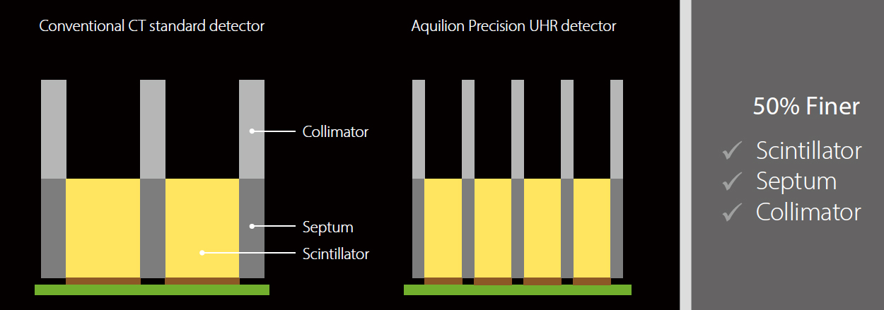 Aquilion Precision 7