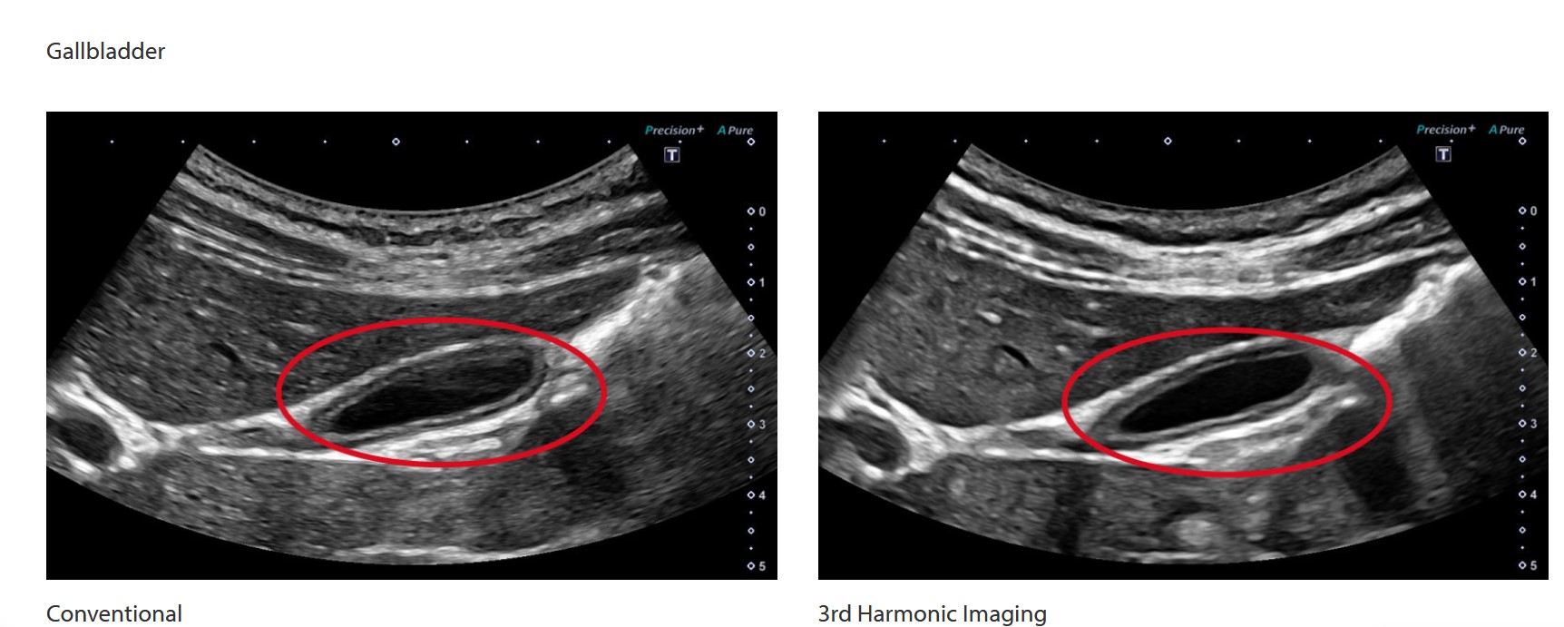 CLINICAL IMAGES ULTRAHANG