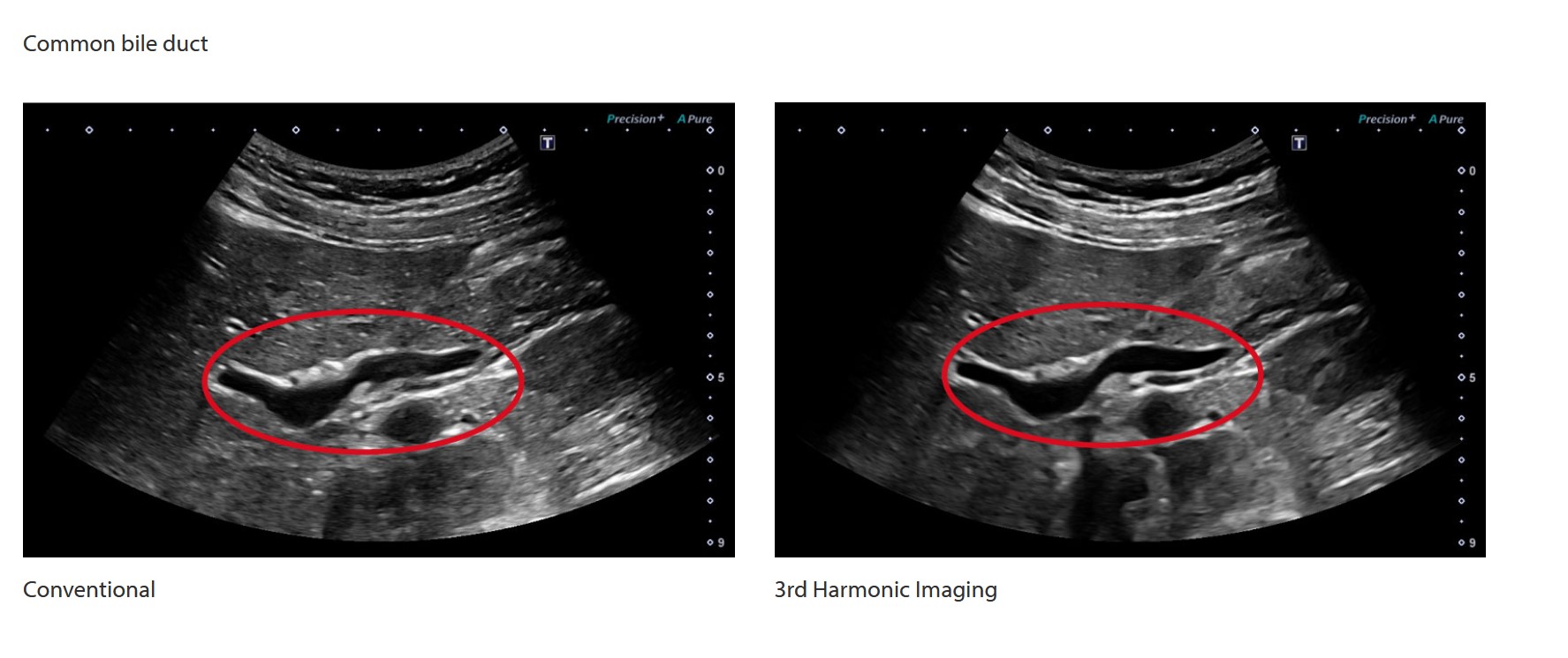CLINICAL IMAGES ULTRAHANG 2
